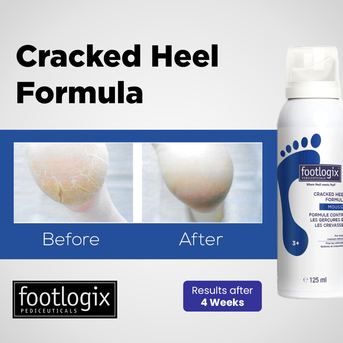 Footlogix - Cracked Heel Formula - Image 2