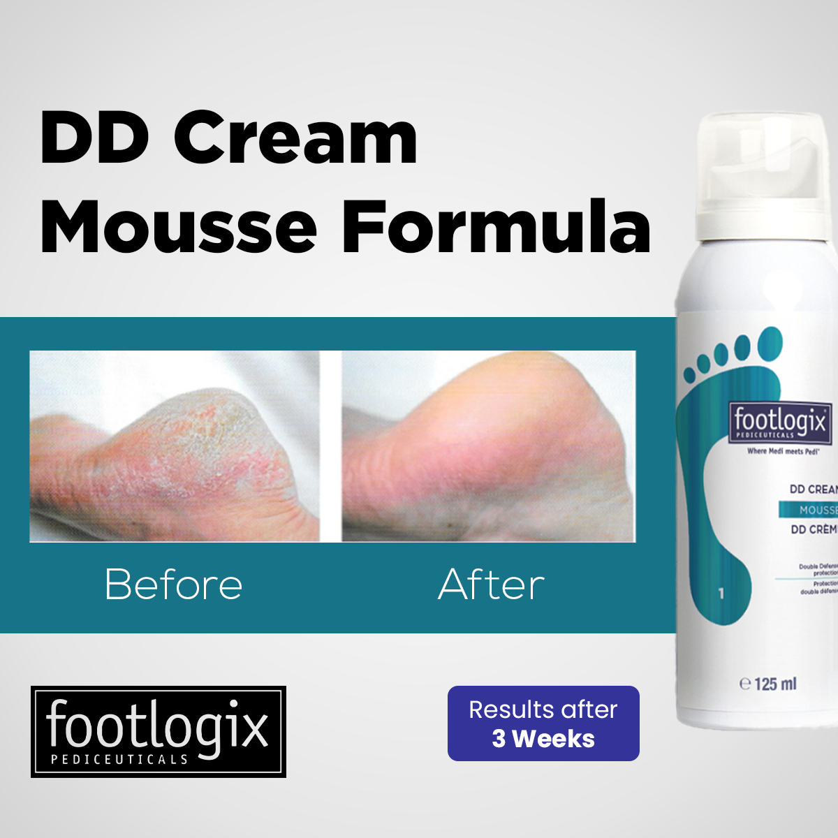 Footlogix - DD Cream Mousse Formula - Image 2