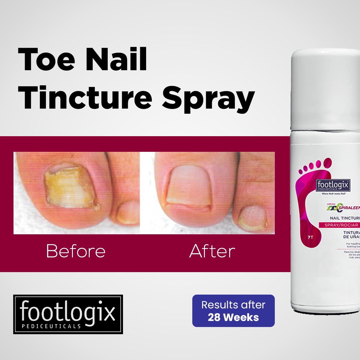 Footlogix - Toe Nail Tincture Spray - Image 2